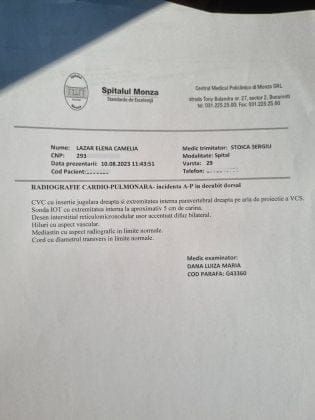 acte cancer cerebral