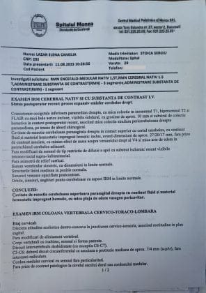acte cancer cerebral