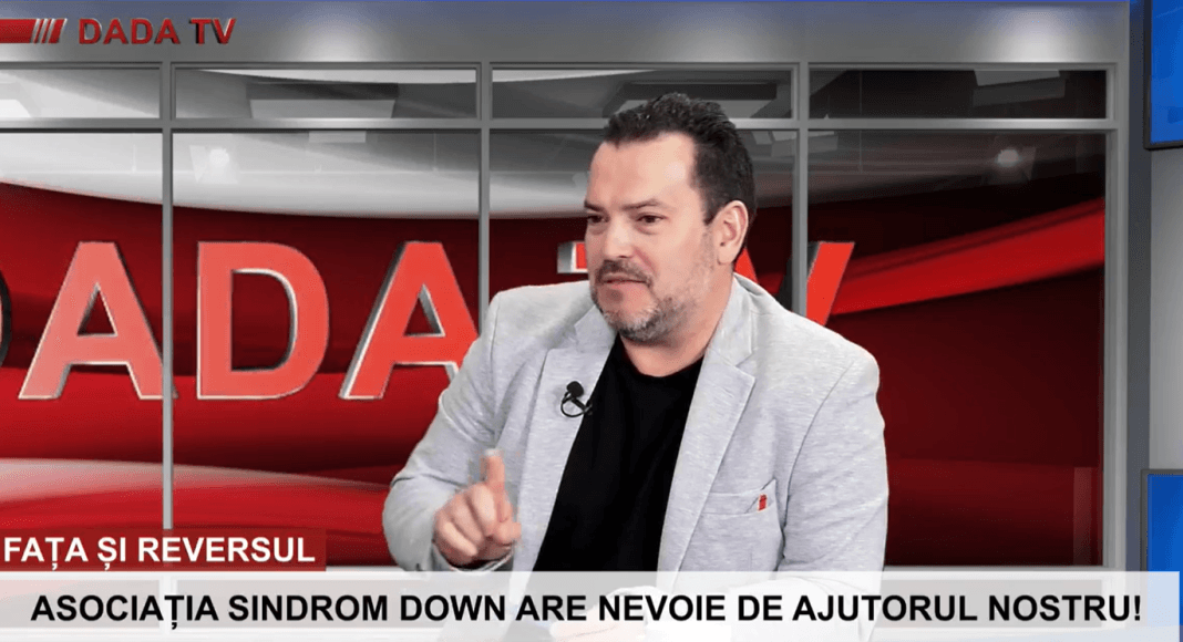 emisiune sindrom down