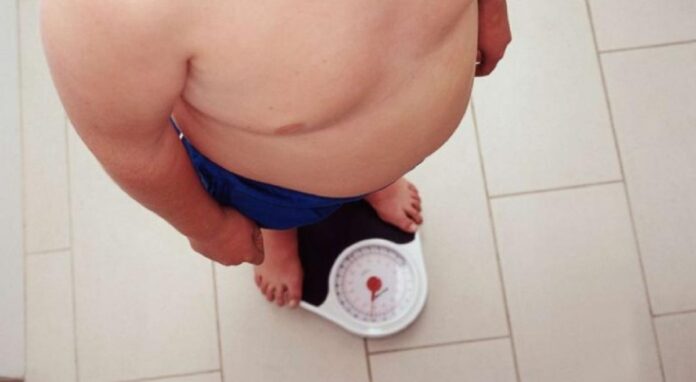 obezitate
