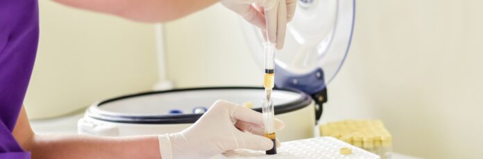 novus medical plasma