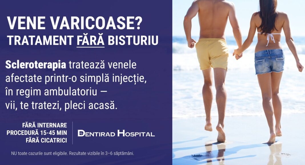 varice dentirad