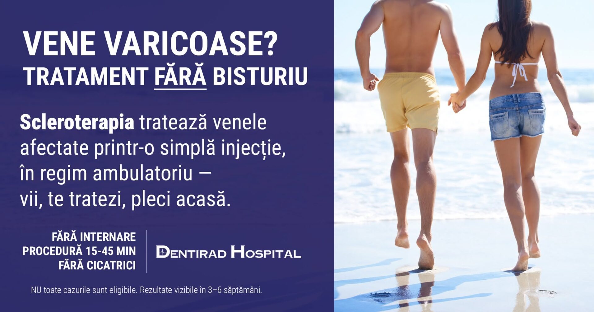 varice dentirad